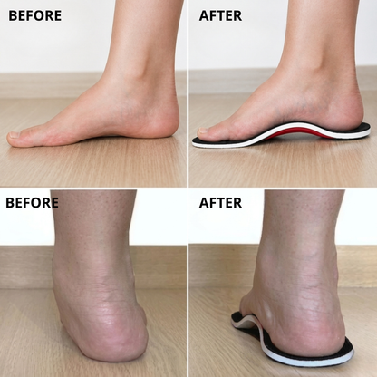 TrueStep® Alignment Insoles